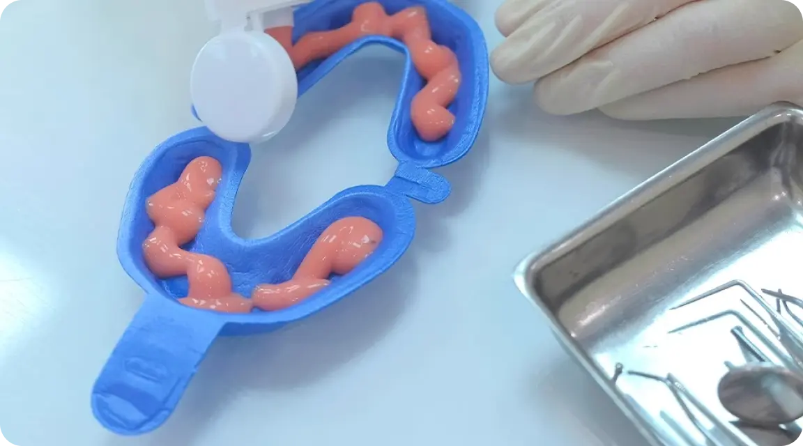 Mouth Tray Preparation